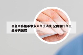 黑色素移植手术多久白斑消失 全国治疗白斑最好的医院