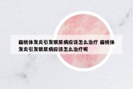 扁桃体发炎引发银屑病应该怎么治疗 扁桃体发炎引发银屑病应该怎么治疗呢