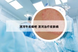 漯河牛皮癣吧 漯河治疗皮肤病