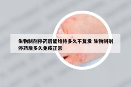 生物制剂停药后能维持多久不复发 生物制剂停药后多久免疫正常