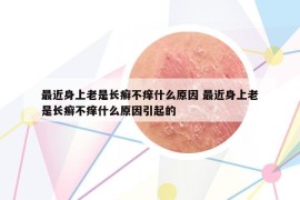 最近身上老是长癣不痒什么原因 最近身上老是长癣不痒什么原因引起的