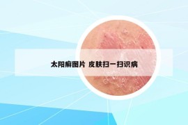 太阳癣图片 皮肤扫一扫识病