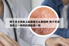 两个月小孩身上起癣是什么原因啊 两个月宝宝身上一块块的像起癣一样