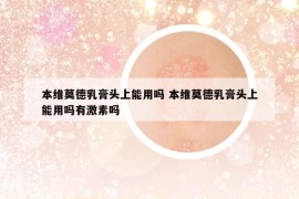 本维莫德乳膏头上能用吗 本维莫德乳膏头上能用吗有激素吗