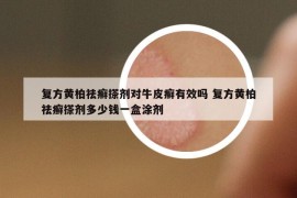 复方黄柏祛癣搽剂对牛皮癣有效吗 复方黄柏祛癣搽剂多少钱一盒涂剂