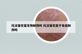 托法替尼是生物制剂吗 托法替尼属于免疫制剂吗