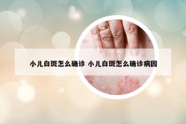 小儿白斑怎么确诊 小儿白斑怎么确诊病因