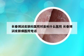长春博润皮肤科医院对面叫什么医院 长春博润皮肤病医院电话