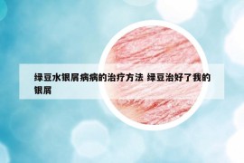 绿豆水银屑病病的治疗方法 绿豆治好了我的银屑