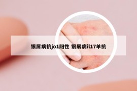 银屑病抗jo1阳性 银屑病il17单抗