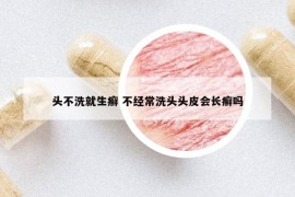 头不洗就生癣 不经常洗头头皮会长癣吗