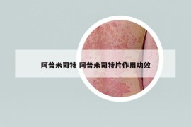 阿普米司特 阿普米司特片作用功效