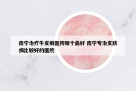 南宁治疗牛皮癣医院哪个最好 南宁专治皮肤病比较好的医院