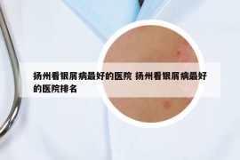 扬州看银屑病最好的医院 扬州看银屑病最好的医院排名