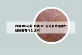 白斑308治疗 白斑308治疗和太阳紫外线照射有什么区别