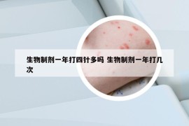 生物制剂一年打四针多吗 生物制剂一年打几次