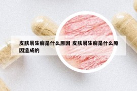 皮肤易生癣是什么原因 皮肤易生癣是什么原因造成的