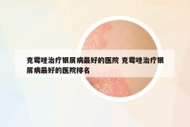 克霉唑治疗银屑病最好的医院 克霉唑治疗银屑病最好的医院排名