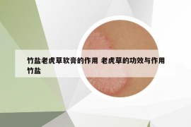 竹盐老虎草软膏的作用 老虎草的功效与作用竹盐