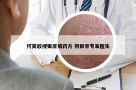 何英教授银屑病药方 何银亭专家医生