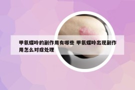 甲氨蝶呤的副作用有哪些 甲氨蝶呤出现副作用怎么对症处理