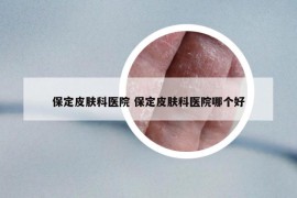 保定皮肤科医院 保定皮肤科医院哪个好