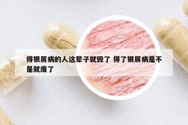 得银屑病的人这辈子就毁了 得了银屑病是不是就废了