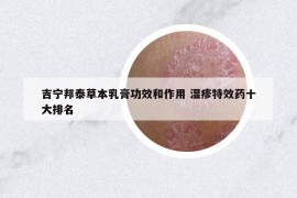 吉宁邦泰草本乳膏功效和作用 湿疹特效药十大排名