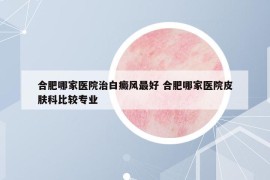 合肥哪家医院治白癜风最好 合肥哪家医院皮肤科比较专业