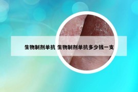 生物制剂单抗 生物制剂单抗多少钱一支