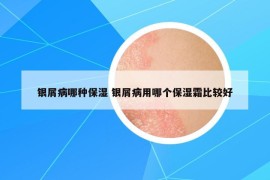 银屑病哪种保湿 银屑病用哪个保湿霜比较好