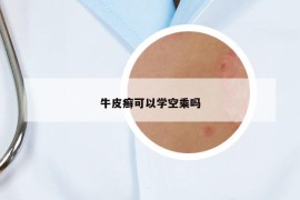 牛皮癣可以学空乘吗