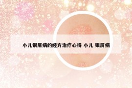 小儿银屑病的经方治疗心得 小儿 银屑病