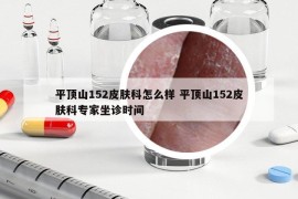 平顶山152皮肤科怎么样 平顶山152皮肤科专家坐诊时间