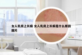 女人乳房上长癣 女人乳房上长癣是什么原因图片