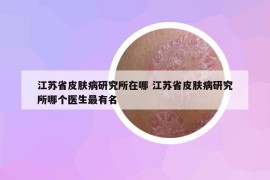 江苏省皮肤病研究所在哪 江苏省皮肤病研究所哪个医生最有名