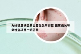 为啥银屑病关节炎要做关节彩超 银屑病关节炎检查项目一切正常