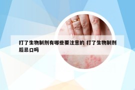 打了生物制剂有哪些要注意的 打了生物制剂后忌口吗