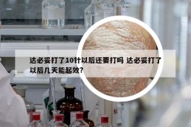 达必妥打了10针以后还要打吗 达必妥打了以后几天能起效?