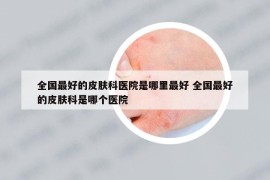 全国最好的皮肤科医院是哪里最好 全国最好的皮肤科是哪个医院