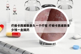 疗癣卡西甫散多久一个疗程 疗癣卡西甫散多少钱一盒国药