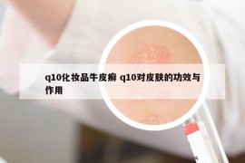 q10化妆品牛皮癣 q10对皮肤的功效与作用