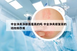 中全净夫净肤霜是真的吗 中全净夫修复膏的功效和作用