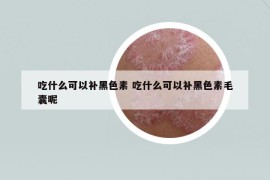 吃什么可以补黑色素 吃什么可以补黑色素毛囊呢