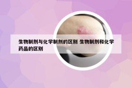 生物制剂与化学制剂的区别 生物制剂和化学药品的区别