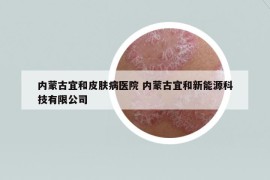 内蒙古宜和皮肤病医院 内蒙古宜和新能源科技有限公司