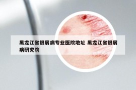 黑龙江省银屑病专业医院地址 黑龙江省银屑病研究院