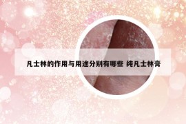 凡士林的作用与用途分别有哪些 纯凡士林膏