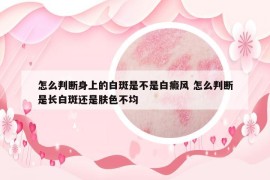 怎么判断身上的白斑是不是白癜风 怎么判断是长白斑还是肤色不均