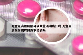 儿童点滴银屑病可以大量活动出汗吗 儿童点滴银屑病有终身不犯的吗
